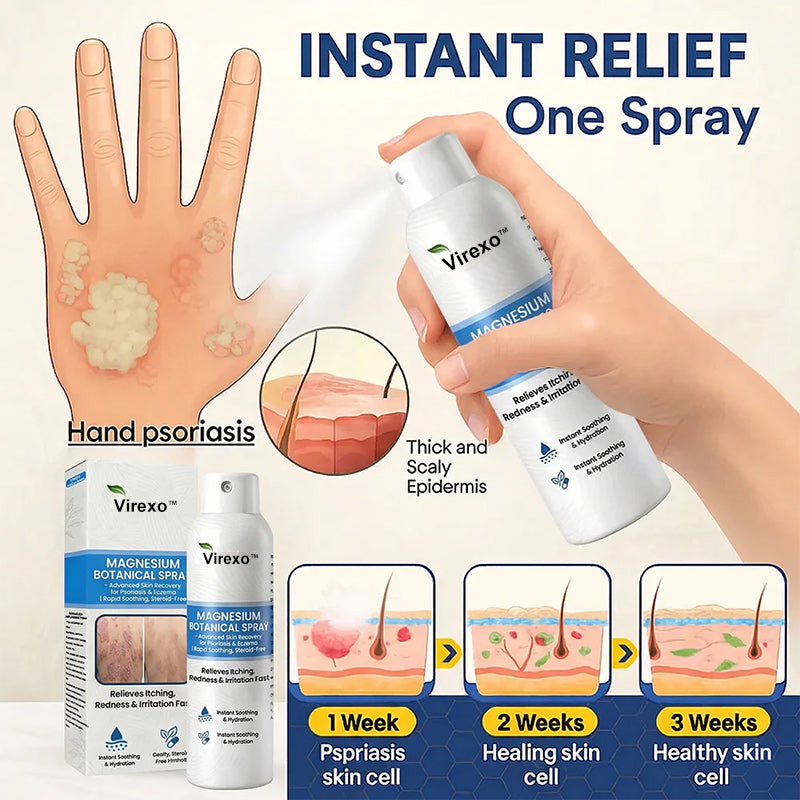 ✅ Official Store | Virexo™ Magnesium Botanical Spray – Advanced Skin Recovery for Psoriasis & Eczema | Rapid Soothing, Steroid-Free