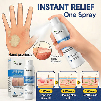 ✅ Official Store | Virexo™ Magnesium Botanical Spray – Advanced Skin Recovery for Psoriasis & Eczema | Rapid Soothing, Steroid-Free
