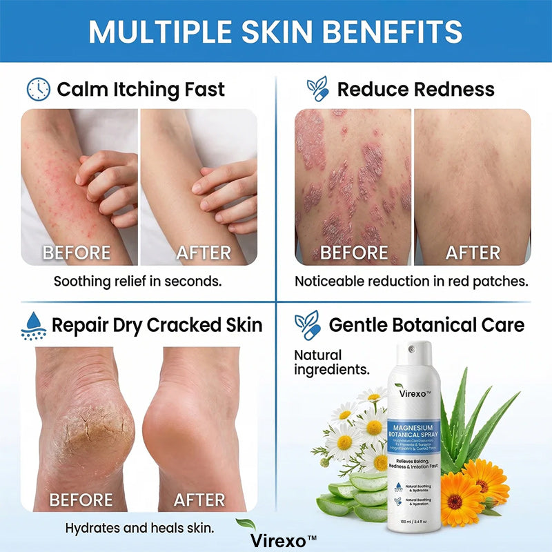 ✅ Official Store | Virexo™ Magnesium Botanical Spray – Advanced Skin Recovery for Psoriasis & Eczema | Rapid Soothing, Steroid-Free