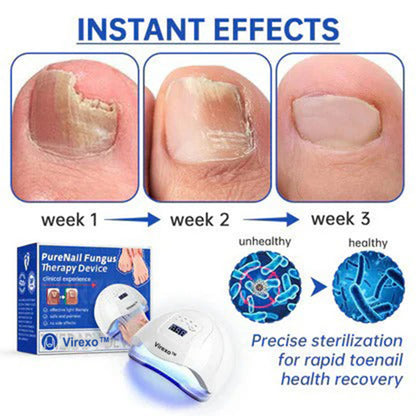 🗽Made and Shipped from USA👏Virexo™ PureNail Fungus Laser Device-✨Last Day Discount -𝟕0%𝐎𝐅𝐅