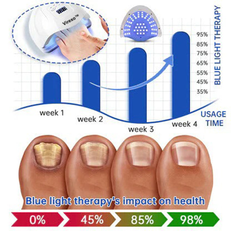 🗽Made and Shipped from USA👏Virexo™ PureNail Fungus Laser Device-✨Last Day Discount -𝟕0%𝐎𝐅𝐅