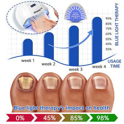 🗽Made and Shipped from USA👏Virexo™ PureNail Fungus Laser Device-✨Last Day Discount -𝟕0%𝐎𝐅𝐅