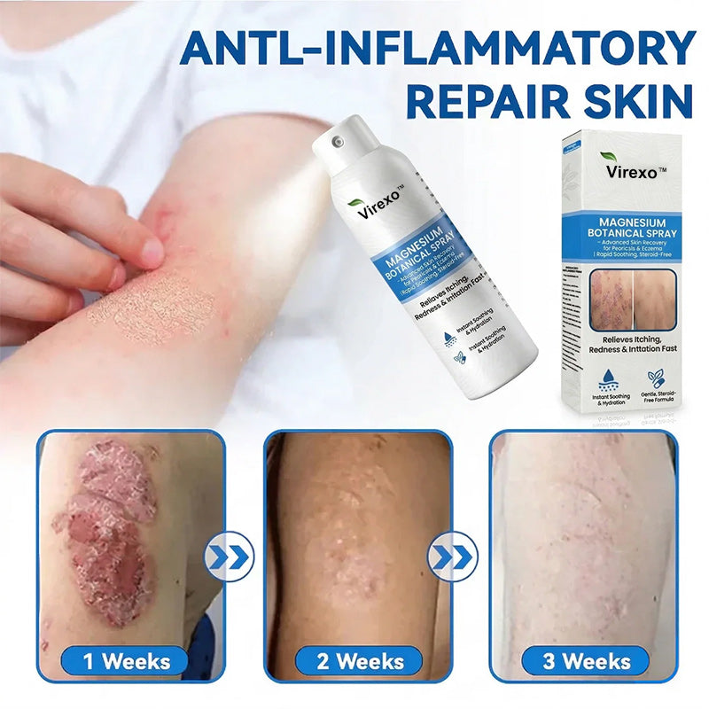 ✅ Official Store | Virexo™ Magnesium Botanical Spray – Advanced Skin Recovery for Psoriasis & Eczema | Rapid Soothing, Steroid-Free